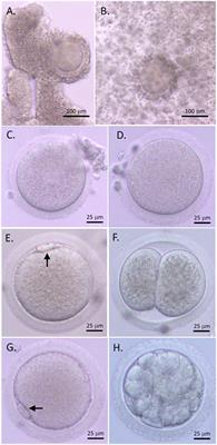 Reduced anti-Müllerian <mark class="highlighted">hormone action</mark> in cumulus-oocyte complexes is beneficial for oocyte maturation without affecting oocyte competence
